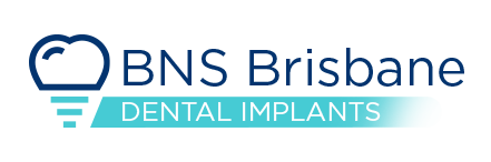 BNS-Brisbane-Dental-Implant